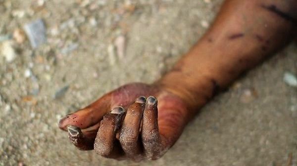 Dead-hand-1