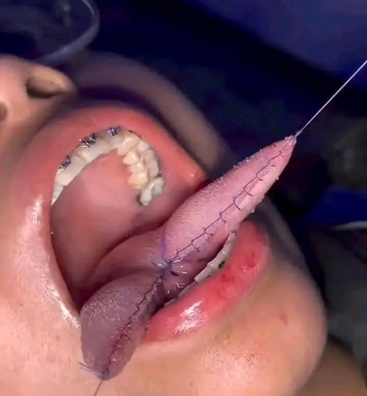 19859978_1774261857650_jpegff773f877692621b9316be3fcccf6873